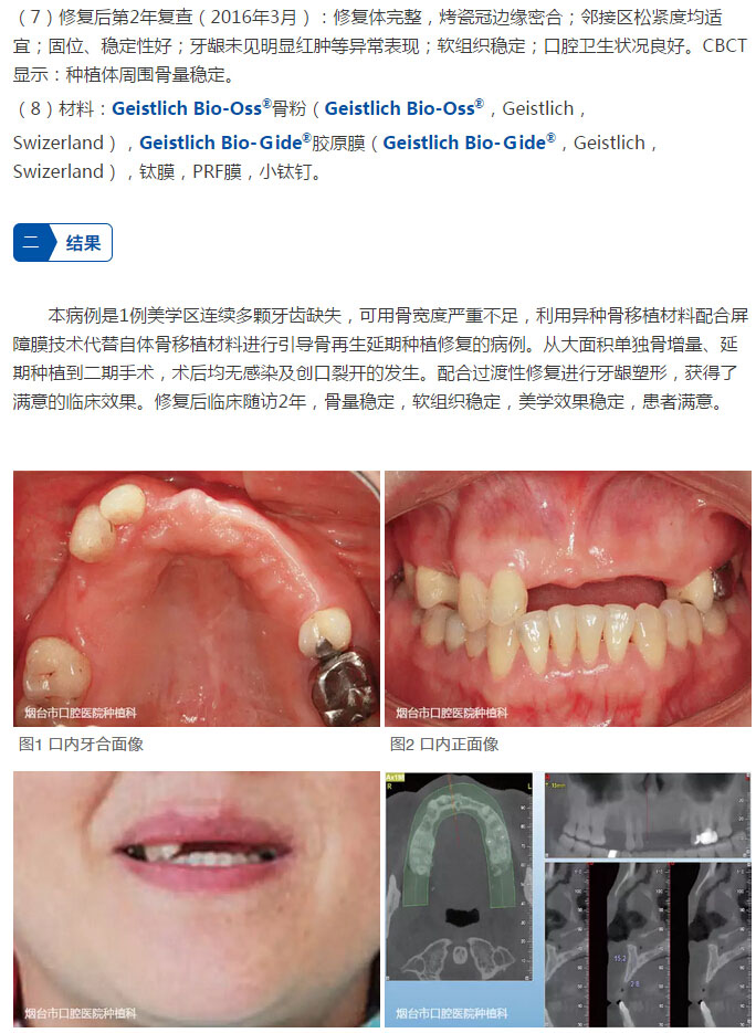 吹膜环评 第6页